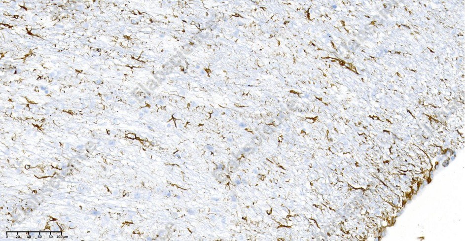 Recombinant GFAP Monoclonal Antibody - 4