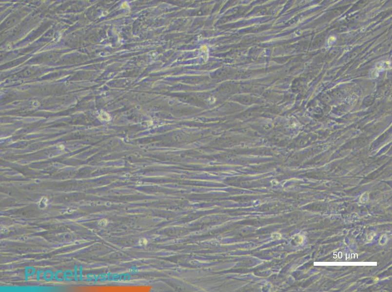 Human Pulmonary Arteriolar Smooth Muscle Cell Complete Medium - 4