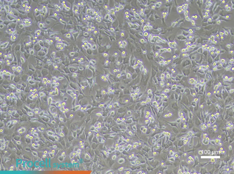 Mouse Intervertebral Disc Annulus Fibrosus Cell Complete Medium - 2