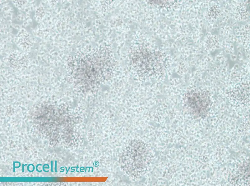 CCRF-SB Cell Complete MediumCCRF-SB Cell Complete Medium - 2