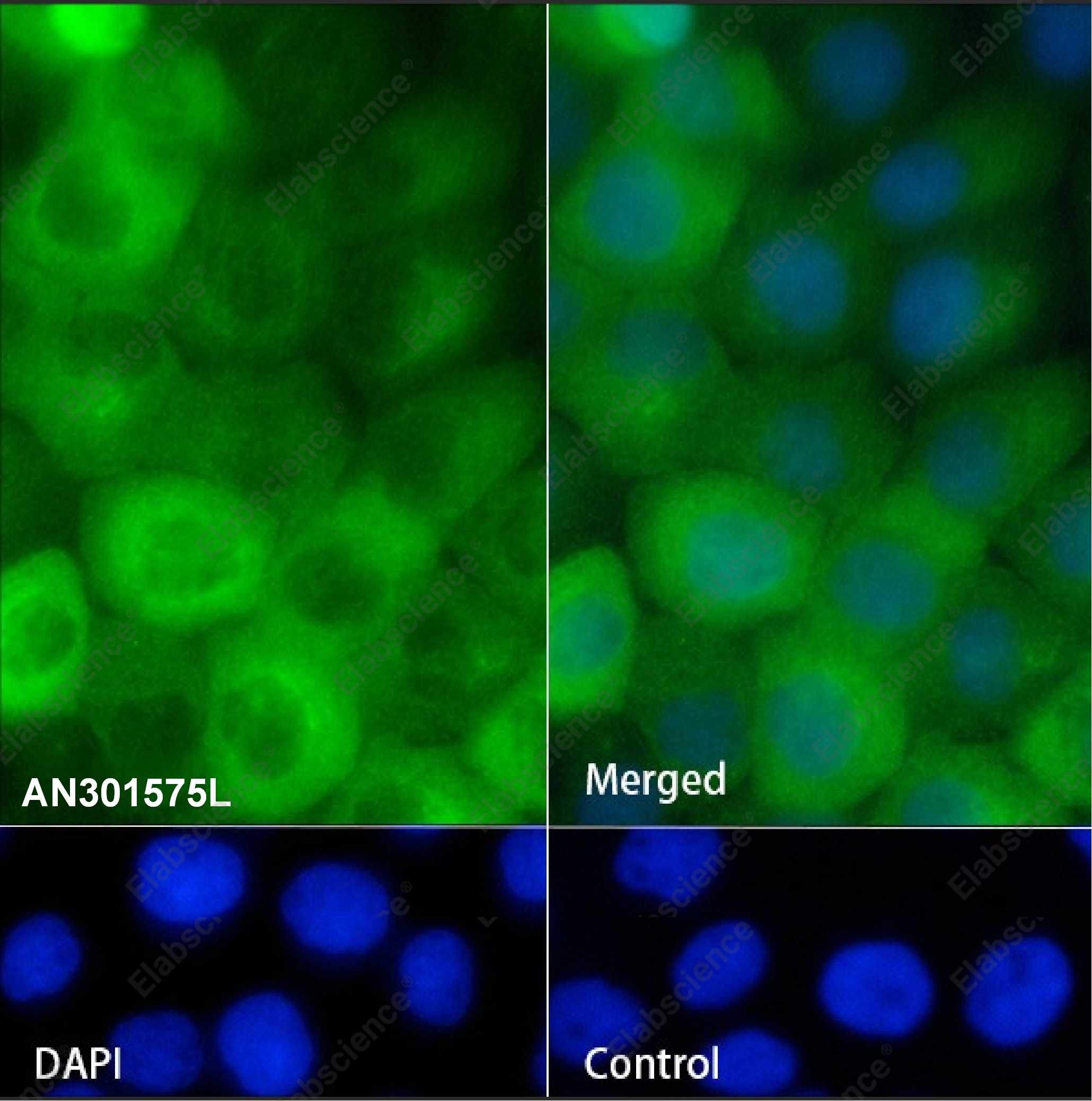 Recombinant Keratin 16 Monoclonal Antibody - 2