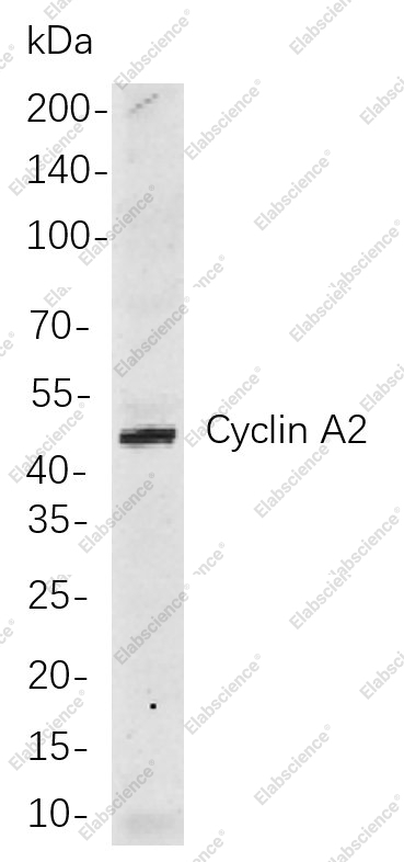 Recombinant Cyclin A2 Monoclonal Antibody - 1