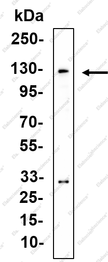 Recombinant FBXW7 Monoclonal Antibody - 1