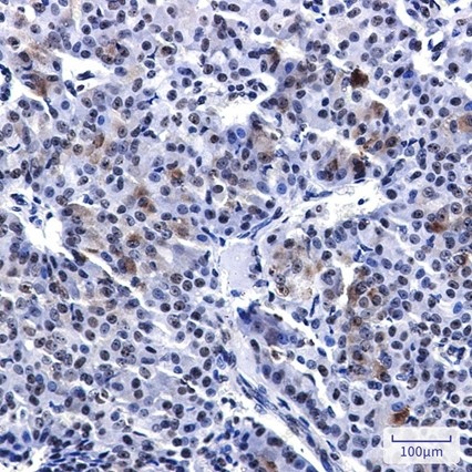 Recombinant PELP1 Monoclonal Antibody - 2