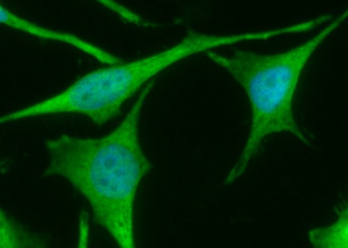 TXNRD1 Monoclonal Antibody - small - 2