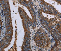 LZTFL1 Polyclonal Antibody - 3