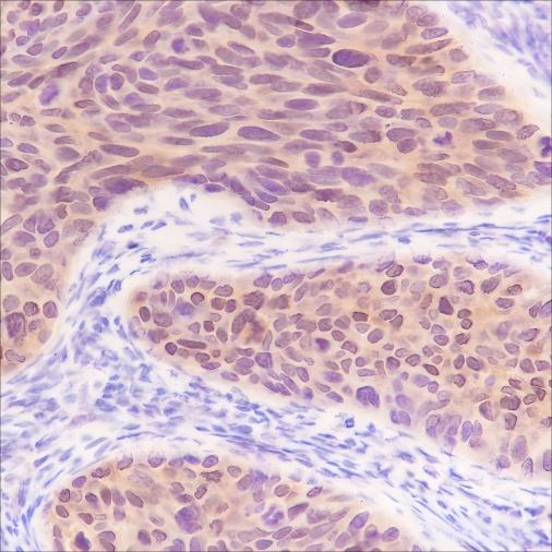 Recombinant S100A2 Monoclonal Antibody - 2