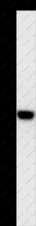 HOXB13 Polyclonal Antibody - 1