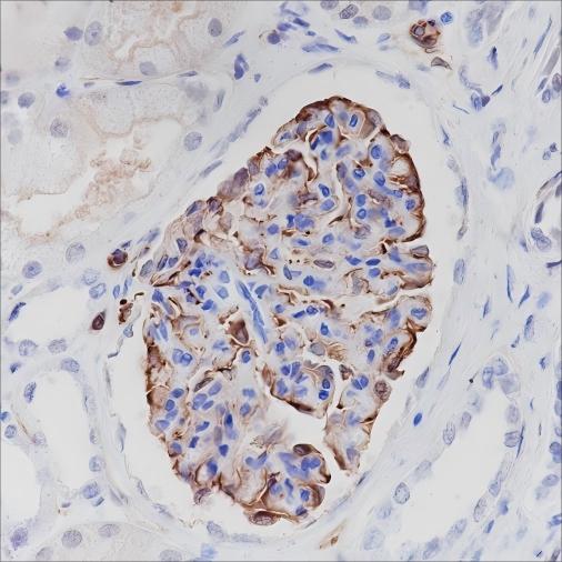 Recombinant Nestin Monoclonal Antibody - 2