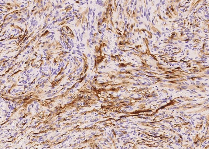 Recombinant S100B Monoclonal Antibody - small - 3