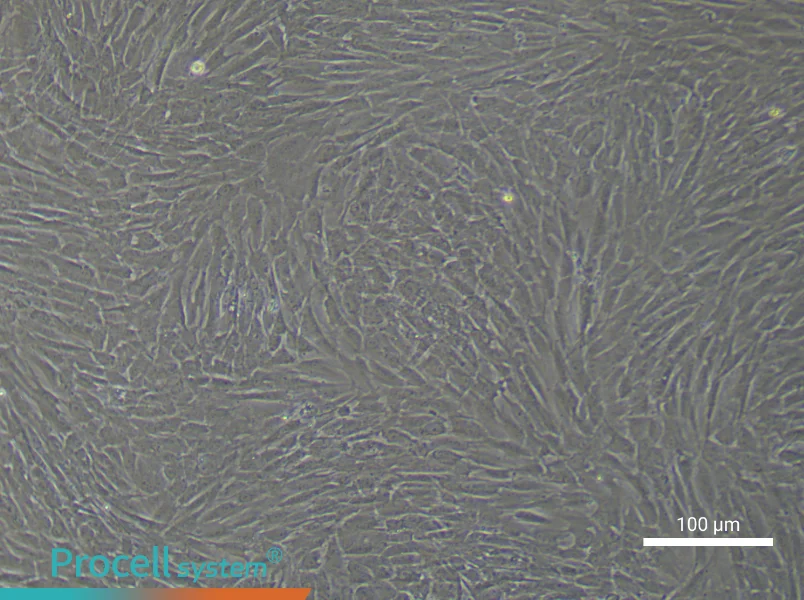 Human Gastric Cancer Fibroblast Complete Medium - 2