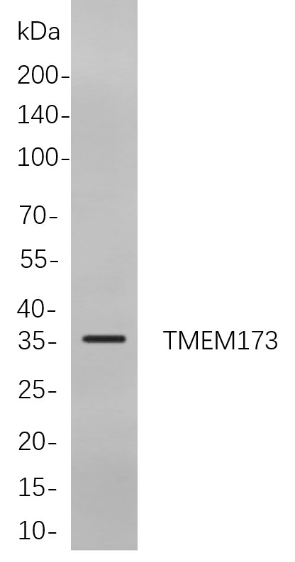 Recombinant TMEM173 Monoclonal Antibody-searchlist-1