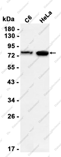 Recombinant Fructose 6 Phosphate Kinase Monoclonal Antibody - 1