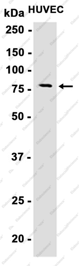 Recombinant Transglutaminase 2 Monoclonal Antibody - 3