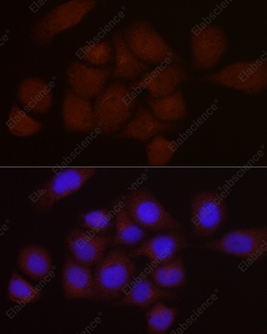 PGC1 alpha Polyclonal Antibody - 3