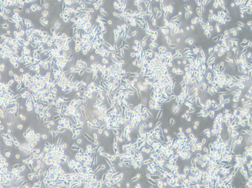 MKN-45 Cell Complete Medium - 2