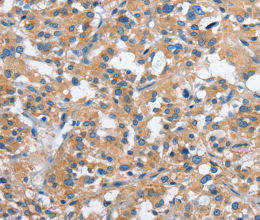PAK2 Polyclonal Antibody - 3
