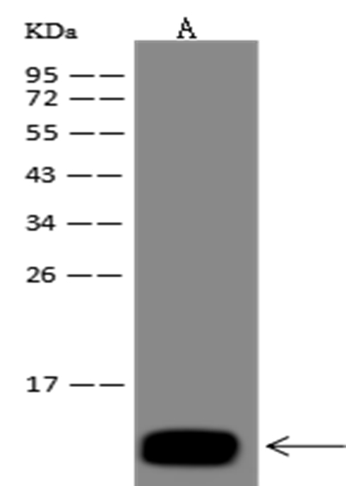 Recombinant S100A8 Monoclonal Antibody - small - 1