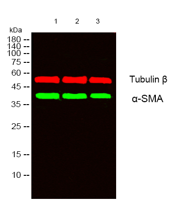 Recombinant α smooth muscle actin Monoclonal Antibody - 2