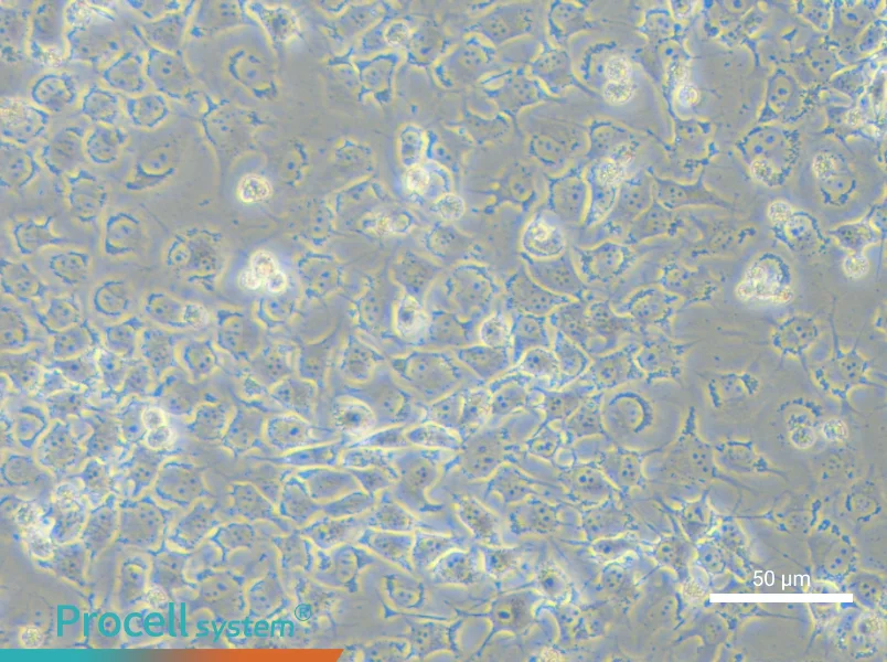 92-1 [Human uveal melanoma] - 4