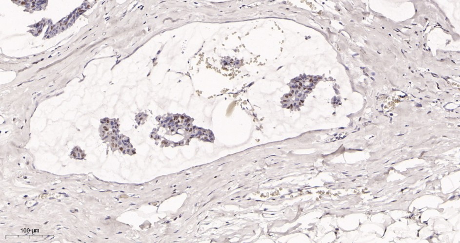 Recombinant Rad21 Monoclonal Antibody - small - 2