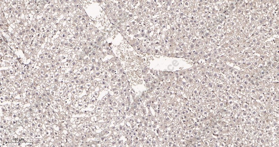 Recombinant Fibrillarin Monoclonal Antibody - 3