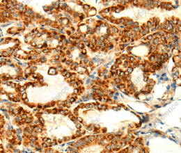 DIABLO Polyclonal Antibody - 2