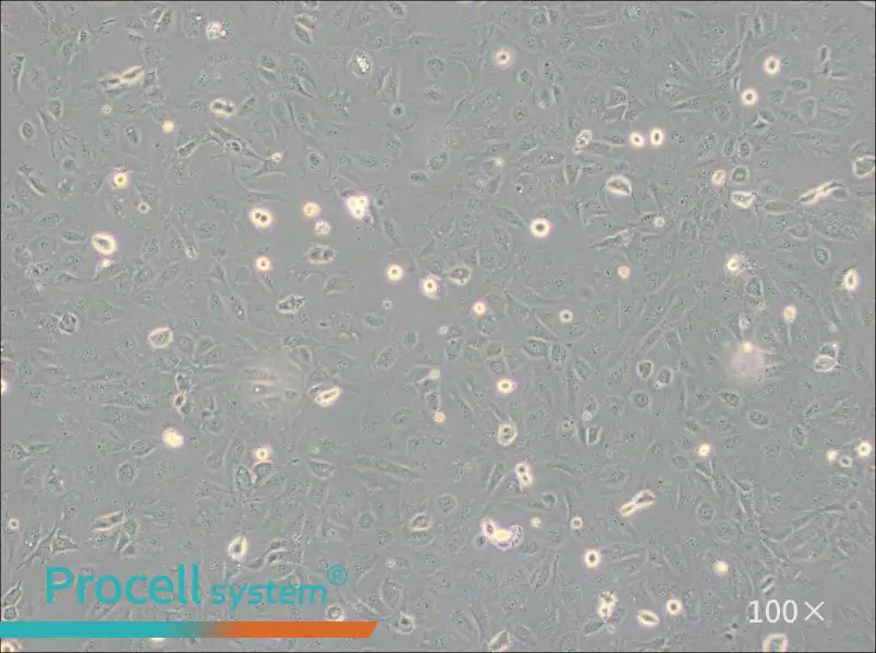 SVEC4-10 Cell Complete Medium - 1