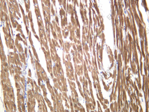 Recombinant PLB Monoclonal Antibody - 3