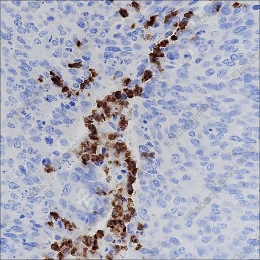 Recombinant CD15/SSEA1 Monoclonal Antibody - 2