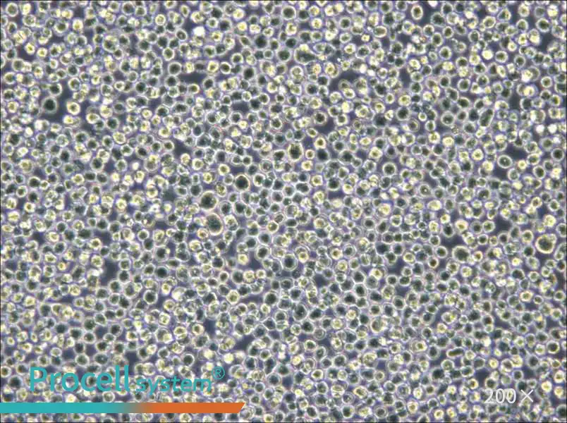 NB4 Cell Complete Medium - small - 5