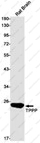 Recombinant TPPP Monoclonal Antibody - 1