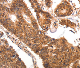 CCL17 Polyclonal Antibody - 2
