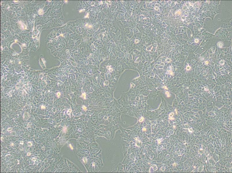 NCI-H2228 [H2228; H-2228] Cell Complete Medium - 3