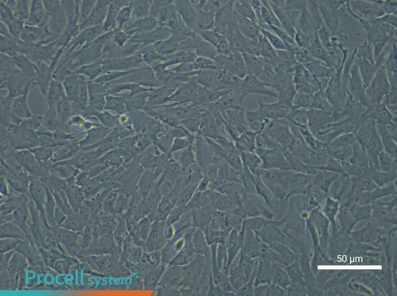 Rat Pulmonary Arteriolar Smooth Muscle Cell Complete Medium - 5