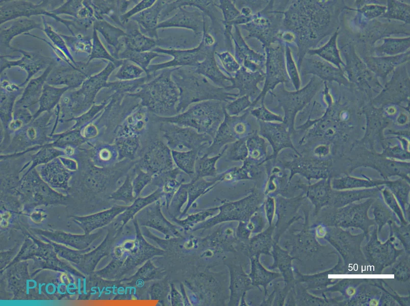 Mouse Cardiac Microvascular Pericyte Complete Medium - small - 5