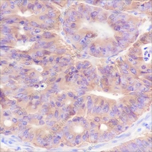 Recombinant Bid Monoclonal Antibody - 2