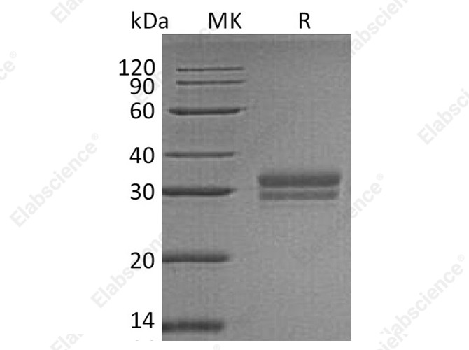 Recombinant Human VSIG2 Protein (His Tag) - 1