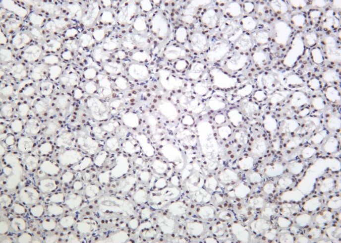 Recombinant Phospho-Smad3 (Ser423, Ser425) Monoclonal Antibody - small - 2