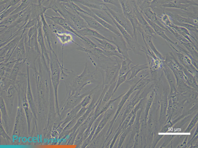 Human Chondrocyte Complete Medium - 4