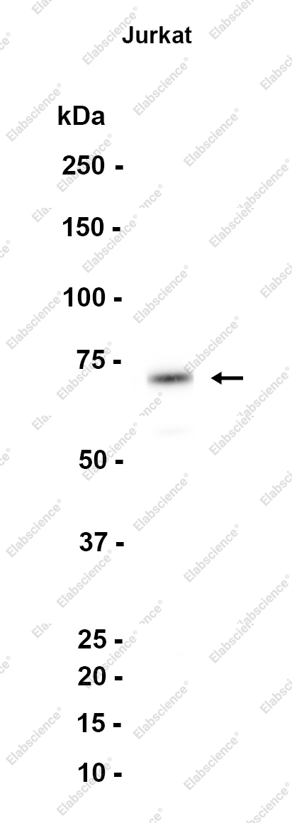 Recombinant LCP1 Monoclonal Antibody - 1