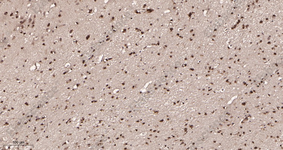 Recombinant p27 KIP 1 Monoclonal Antibody - 2