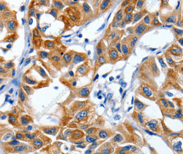 IGF2BP1 Polyclonal Antibody - 3
