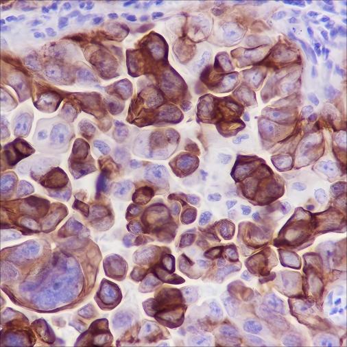 Recombinant MUC4 Monoclonal Antibody - small - 2