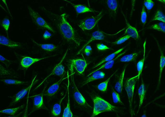 Recombinant ARG1/Arginase 1 Monoclonal Antibody - small - 5