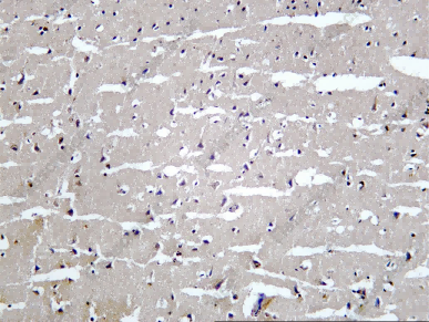 Recombinant EAAT2 Monoclonal Antibody - 1