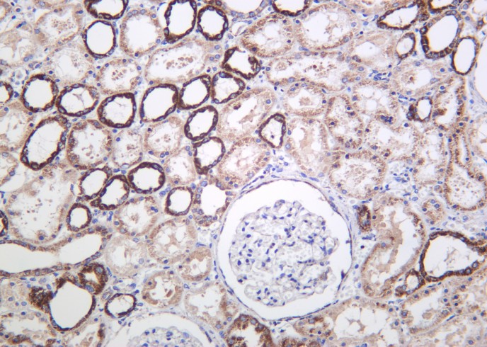 Recombinant Cyclophilin F Monoclonal Antibody-searchlist-1