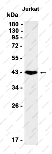 Recombinant CD79a Monoclonal Antibody - 1