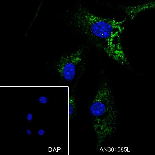 Recombinant Laminin beta 1 Monoclonal Antibody - small - 2