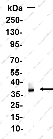 Recombinant Aurora C Monoclonal Antibody - 1